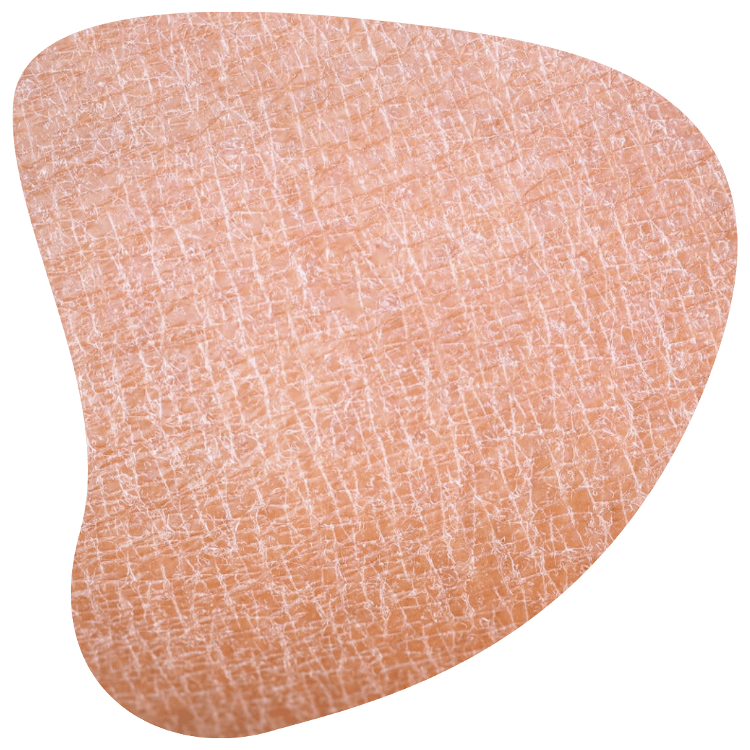 Trockene Haut im Gesicht Foto