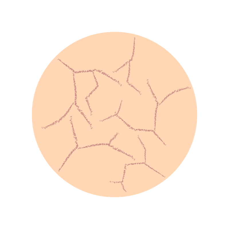 runde Zeichnung trockener Haut - Risse in der Haut